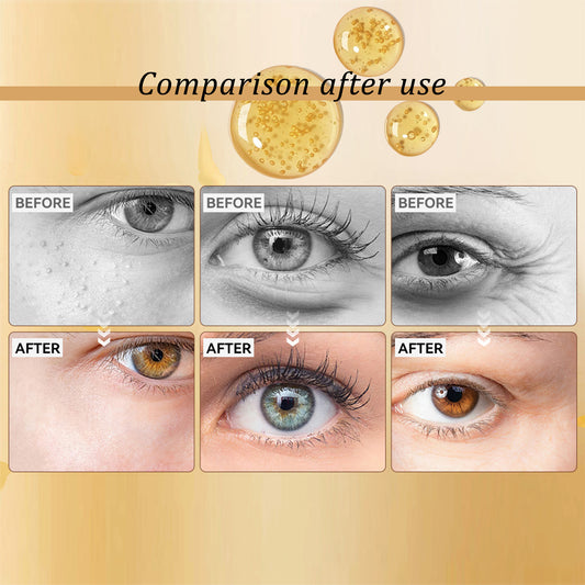 Snail Peptide Eye Cream with Cooling Roller - Reduce Dark Circles & Puffiness