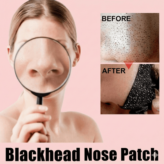 Blackhead Remover Nose Strips - 10 Pack Deep Pore Cleansing Patches