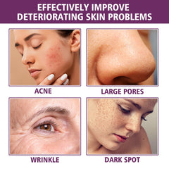 EELHOE Niacinamide Serum – Brightening, Pore-Minimizing & Anti-Wrinkle Essence