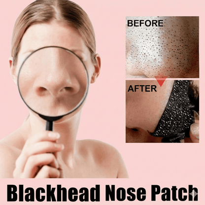 Blackhead Remover Nose Strips - 10 Pack Deep Pore Cleansing Patches