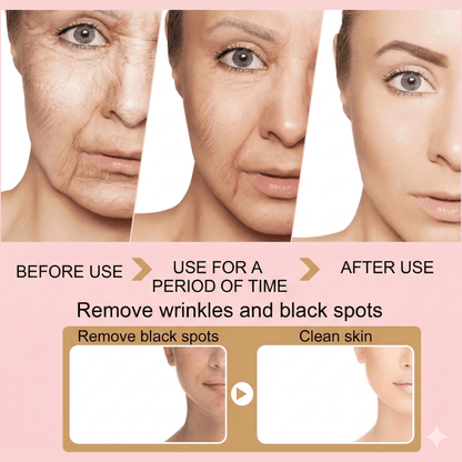 Turmeric Dark Spot Correcting Serum - Fade Hyperpigmentation & Even Skin Tone