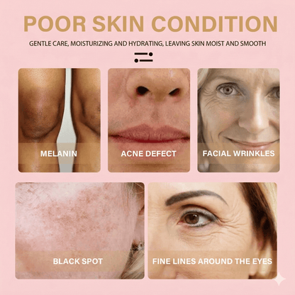 Turmeric Dark Spot Correcting Serum - Fade Hyperpigmentation & Even Skin Tone