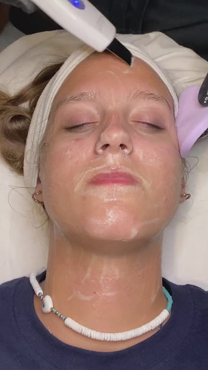 Ultrasonic Skin Scrubber - Professional Blackhead & Pore Cleaner
